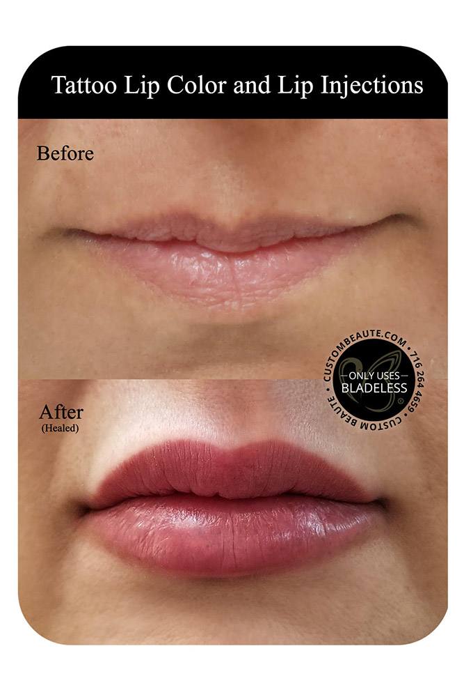 Tattoo Lip Color and Lip Injections in Amherst Buffalo NY
