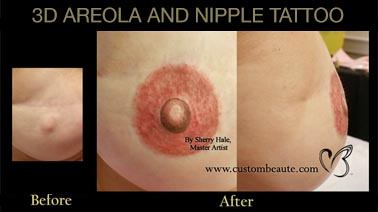 Before and after 3D areola and nipple tatoo