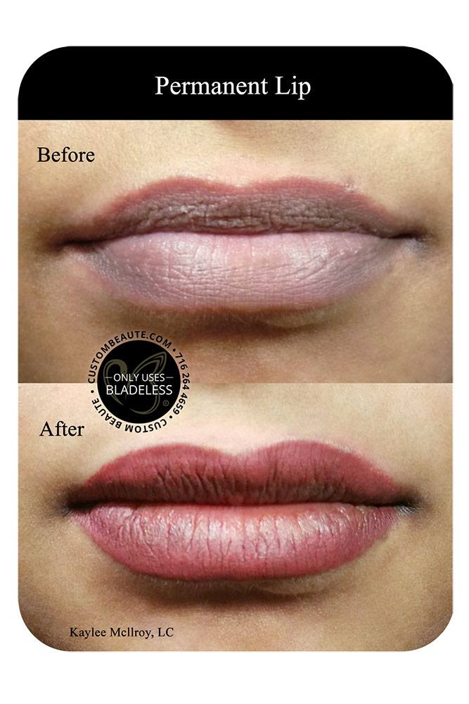 Before and After Permanent Lip - Amherst NY